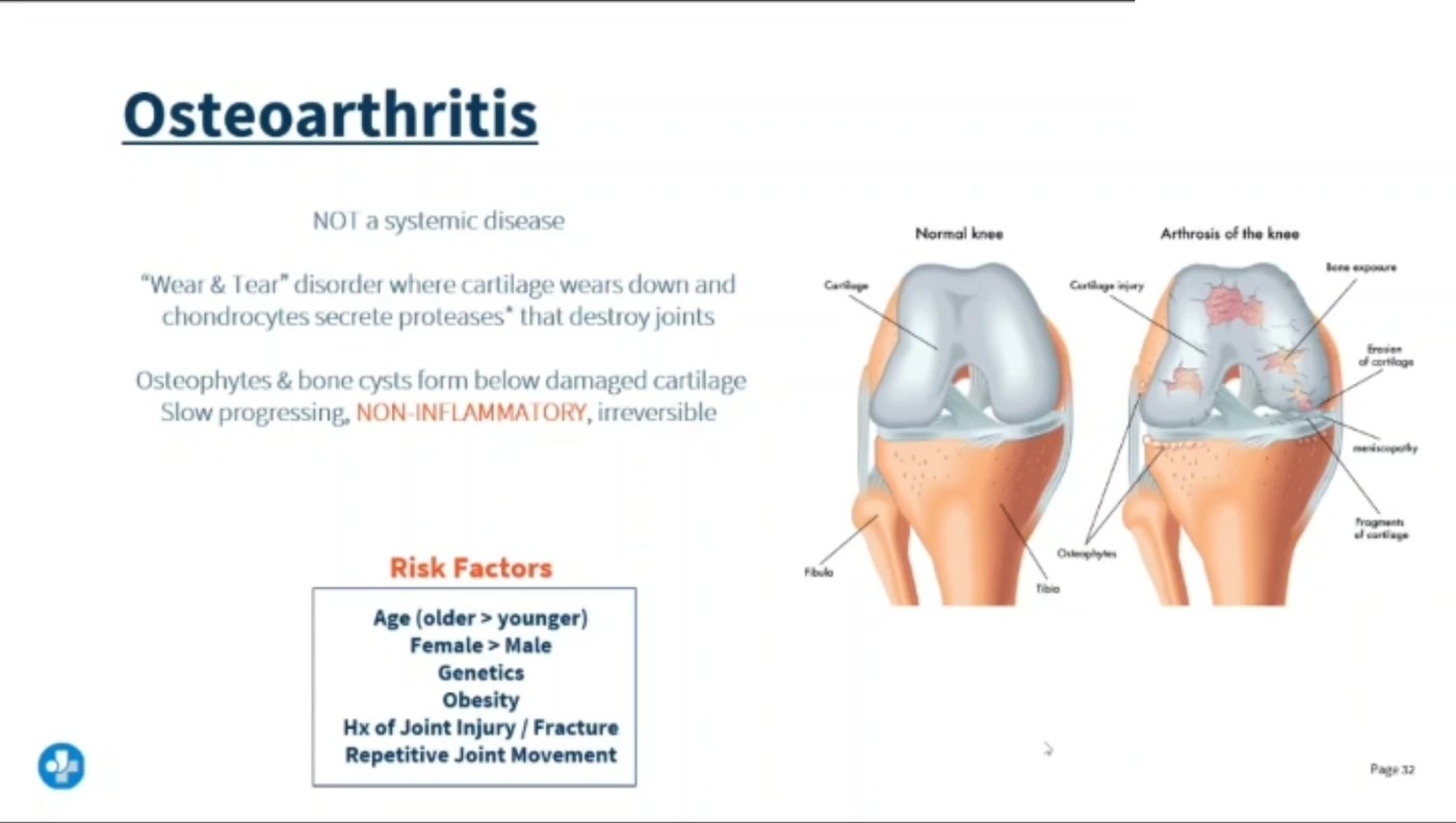 Lecture slide on osteoarthritis contrasting a normal knee with an arthritic knee showing cartilage injury, bone exposure, erosion of cartilage and osteophytes, with a risk factor list.