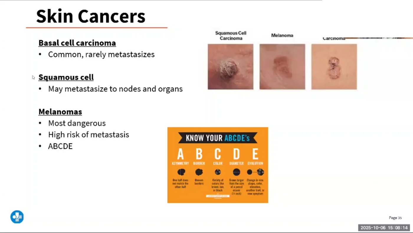 Lecture slide on skin cancers showing photographs of squamous cell carcinoma, melanoma and basal cell carcinoma, with the ABCDE rule for melanoma: asymmetry, border, color, diameter and evolution.