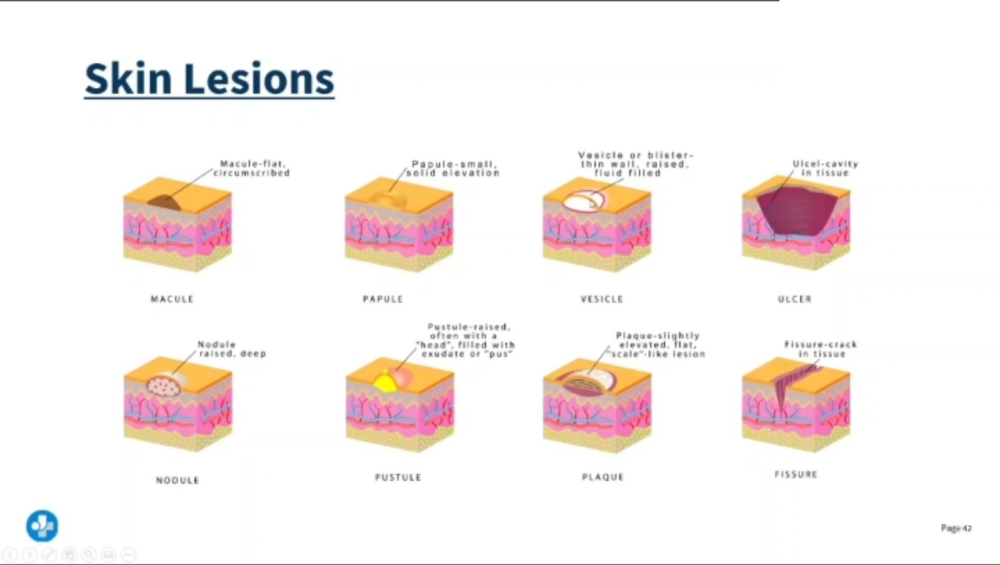 Lecture slide showing eight primary skin lesion types in cross-section: macule, papule, vesicle, ulcer, nodule, pustule, plaque and fissure, each drawn through the skin layers.